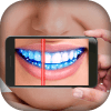 TeethGermScannerSimulator